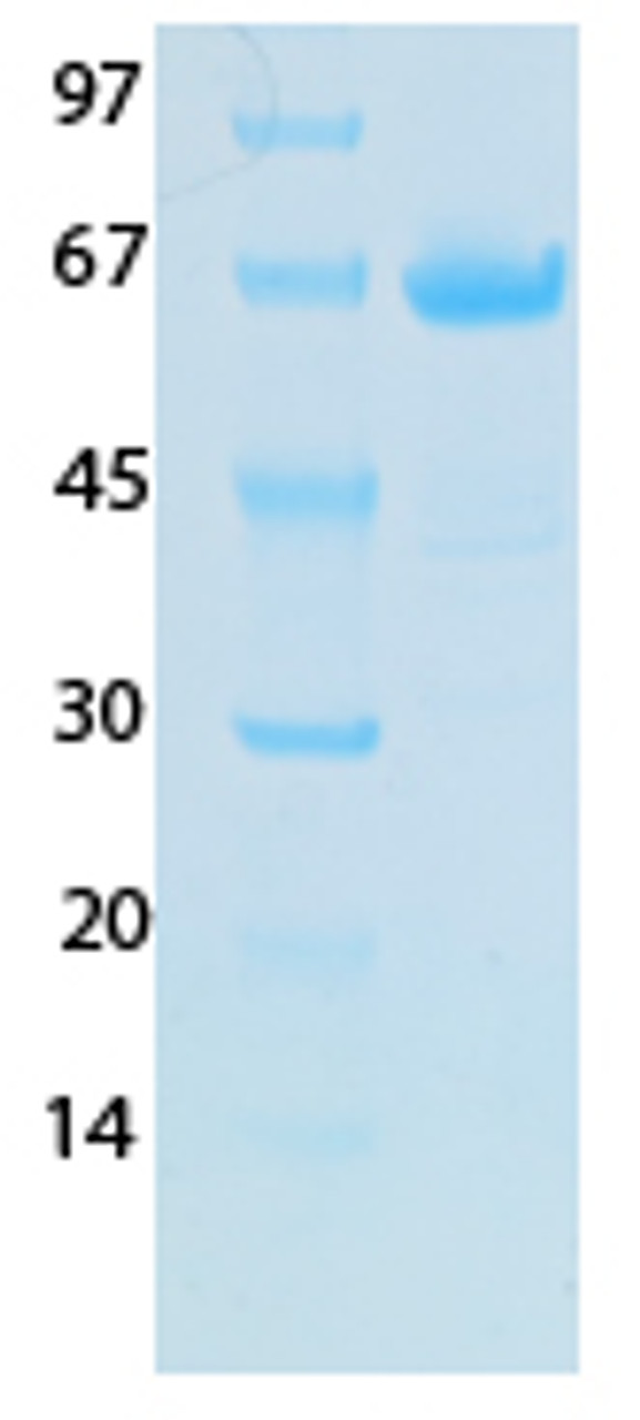 SARS-CoV-2 (COVID-19) NSP1 Recombinant Protein | 20-218