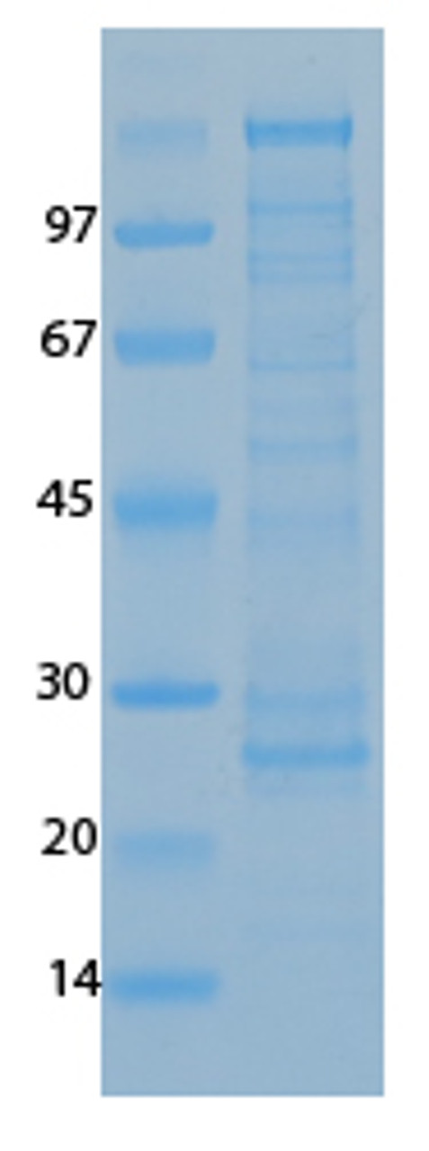 SARS Coronavirus spike (HSZ-Cc) Recombinant Protein | 20-219