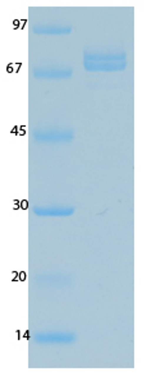 SARS Coronavirus Nucleocapsid (HSZ-Cc) Recombinant Protein | 20-220