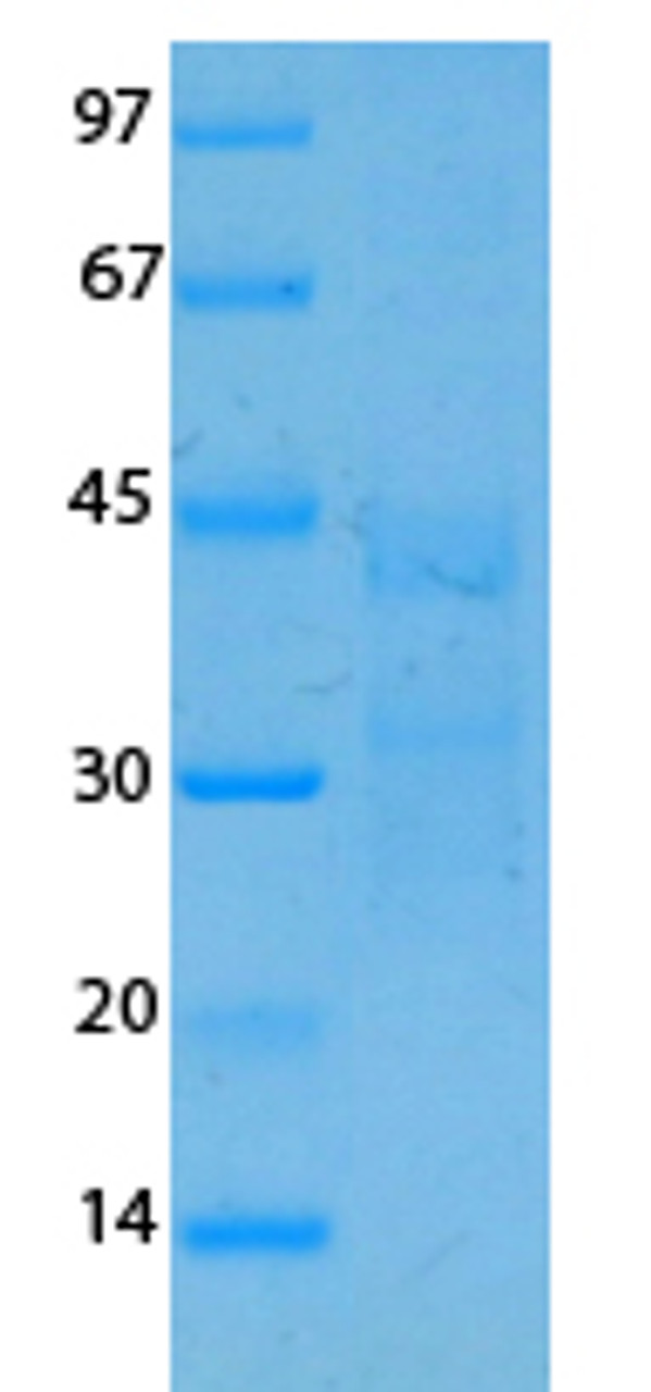 SARS Coronavirus Membrane (HSZ-Cc) Recombinant Protein | 20-221