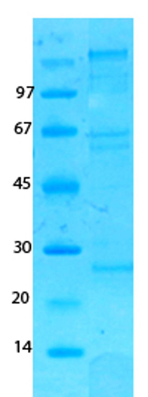 MERS Coronavirus spike (HSZ-Cc) Recombinant Protein | 20-223