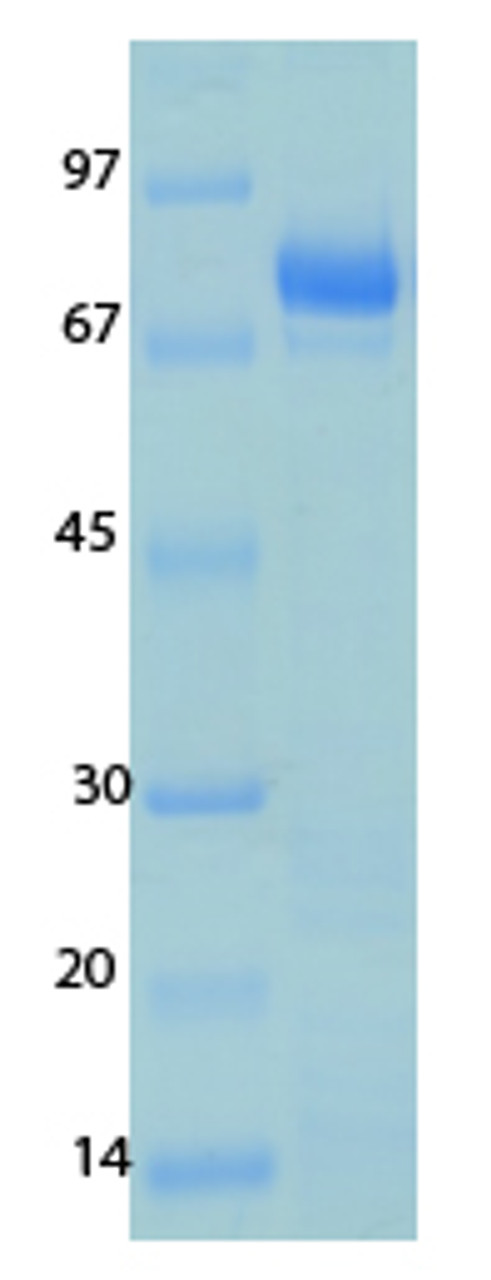 Human Coronavirus Nucleocapsid OC43 Recombinant Protein | 20-227