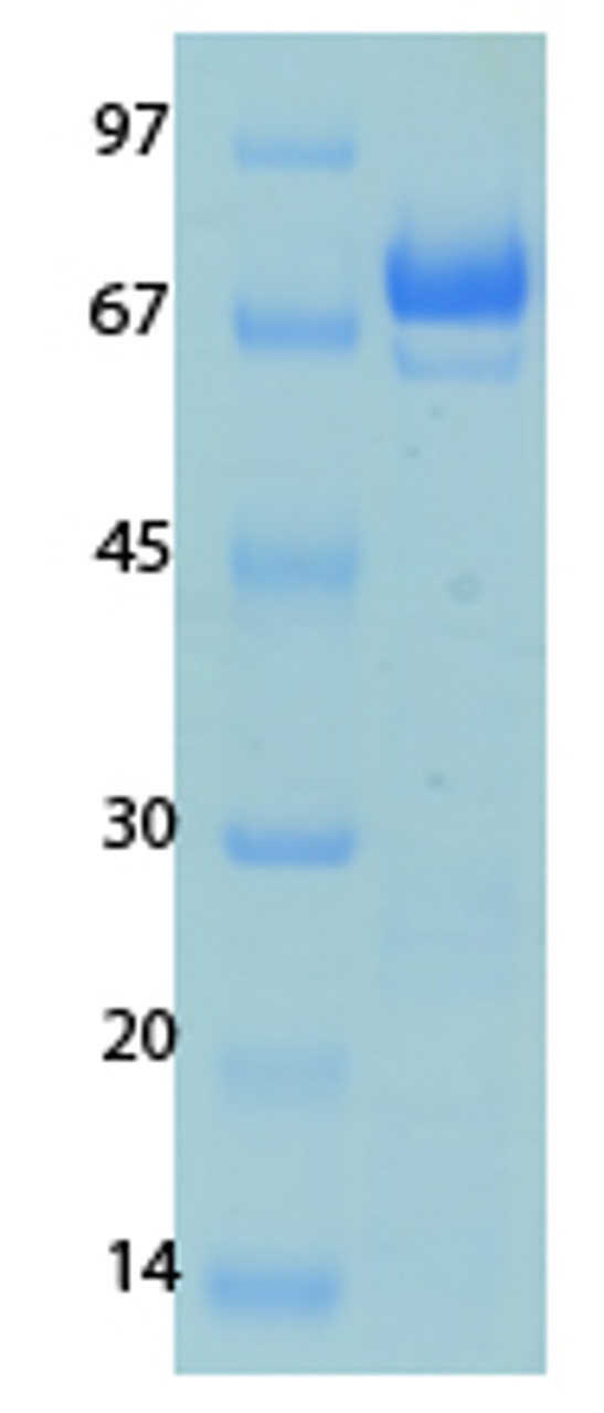 Human Coronavirus Nucleocapsid (229E) Recombinant Protein | 20-228