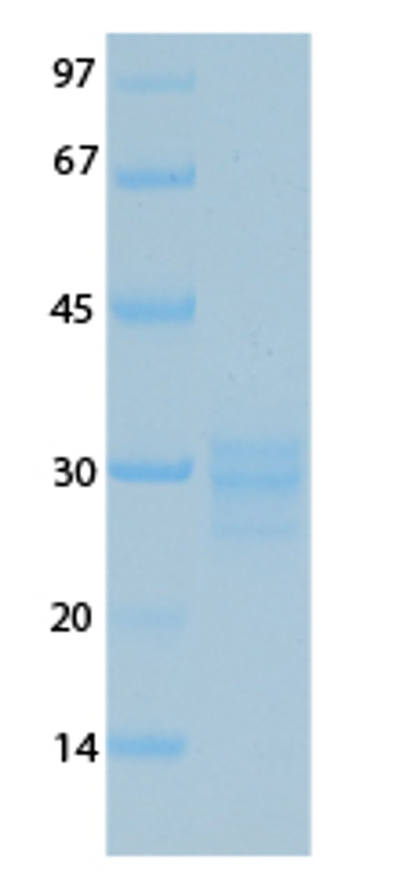 SARS-CoV-2 (COVID-19) Envelope Recombinant Protein | 20-231