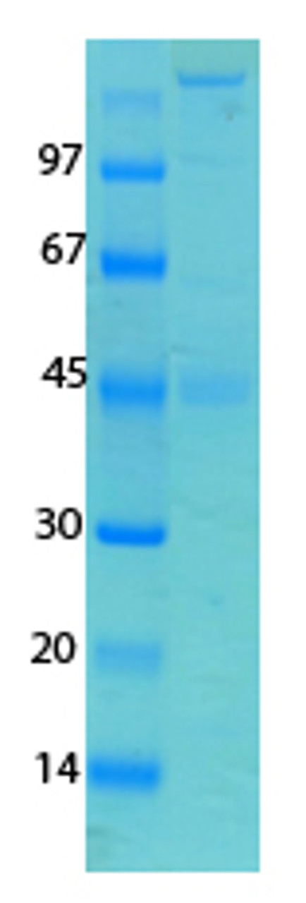 SARS-CoV-2 (COVID-19) Spike Recombinant Protein | 20-233