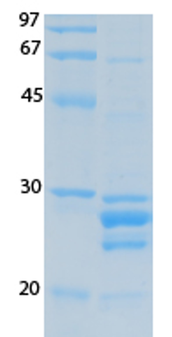 SARS-CoV-2 (COVID-19) ORF10 Recombinant Protein | 20-234