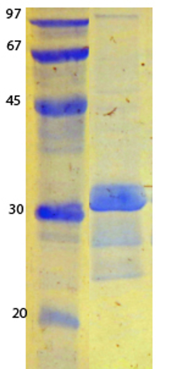 SARS-CoV-2 (COVID-19) ORF9B Recombinant Protein | 20-235