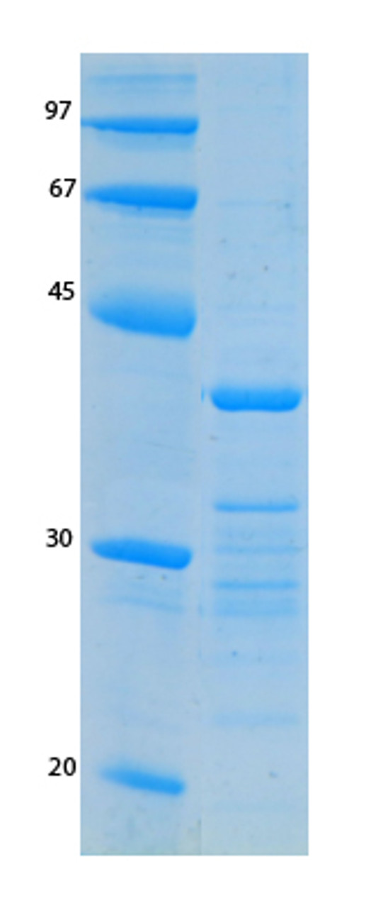 SARS-CoV-2 (COVID-19) ORF8 Recombinant Protein | 20-237