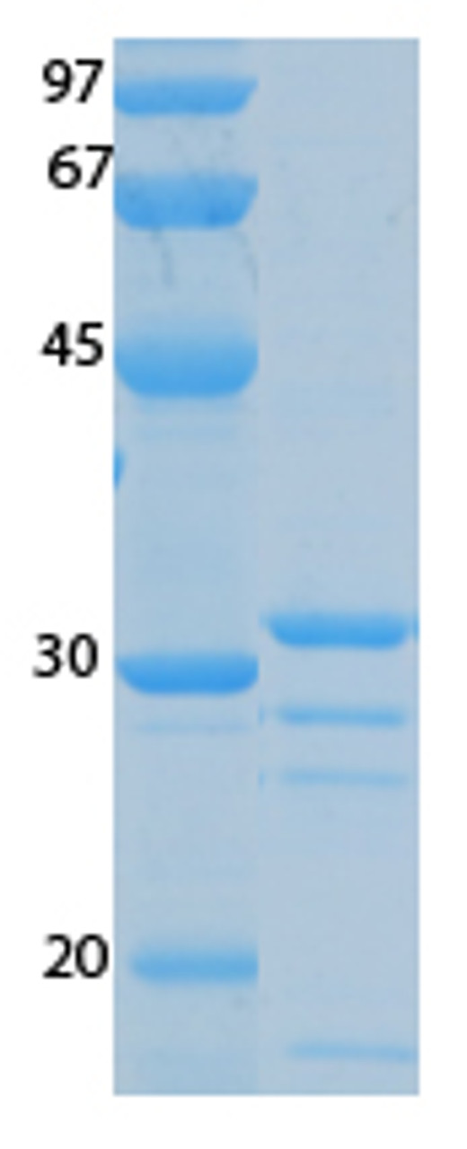 SARS-CoV-2 (COVID-19) ORF7B Recombinant Protein | 20-238