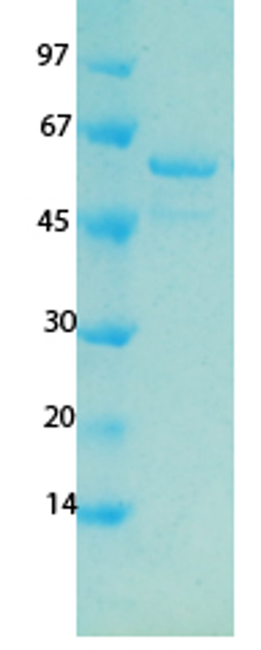 SARS-CoV-2 (COVID-19) ORF7A Recombinant Protein | 20-239