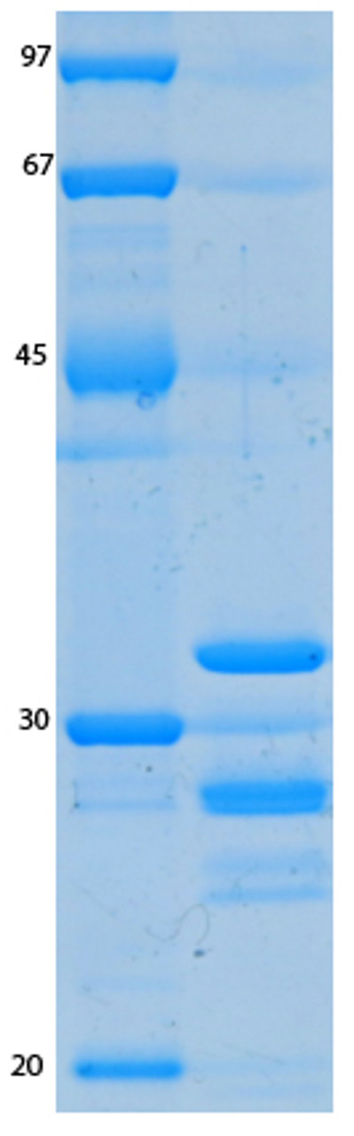 SARS-CoV-2 (COVID-19) ORF6 Recombinant Protein | 20-240