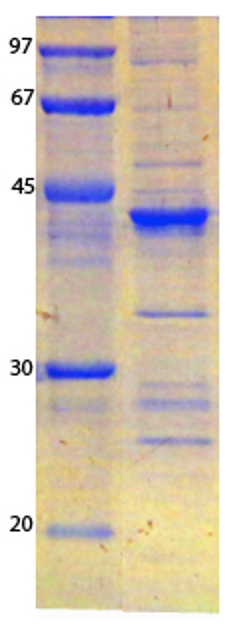 SARS-CoV-2 (COVID-19) ORF3B Recombinant Protein | 20-241