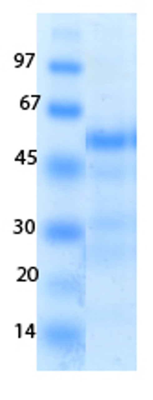 SARS-CoV-2 (COVID-19) ORF3A Recombinant Protein | 20-242