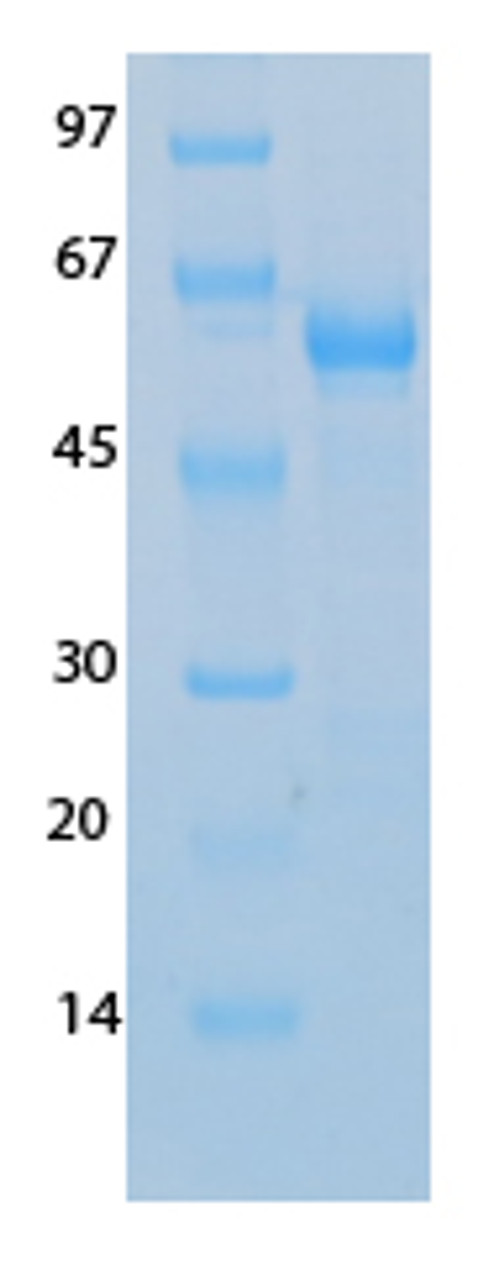 SARS-CoV-2 (COVID-19) NSP16 Recombinant Protein | 20-243