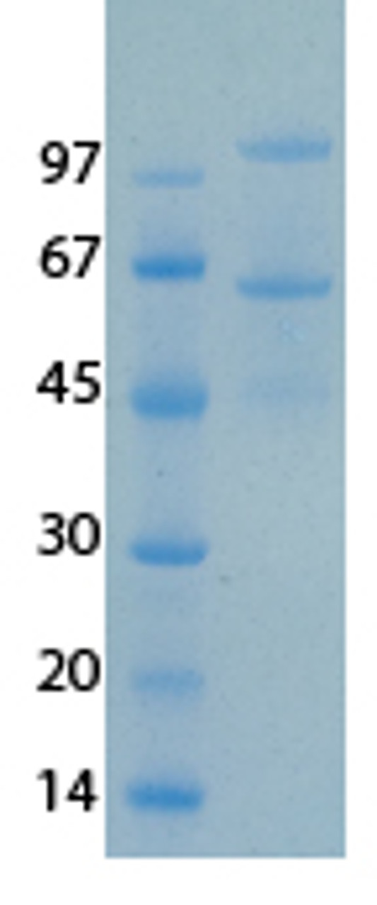 SARS-CoV-2 (COVID-19) NSP15 Recombinant Protein | 20-244