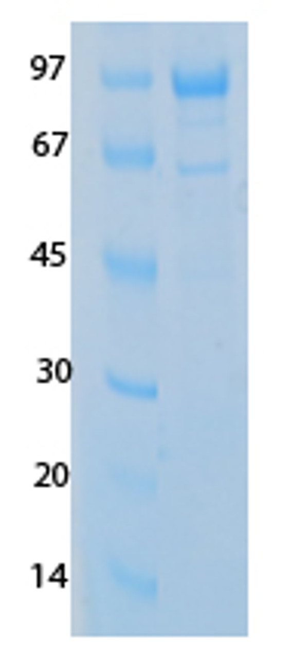 SARS-CoV-2 (COVID-19) NSP13 Recombinant Protein | 20-246