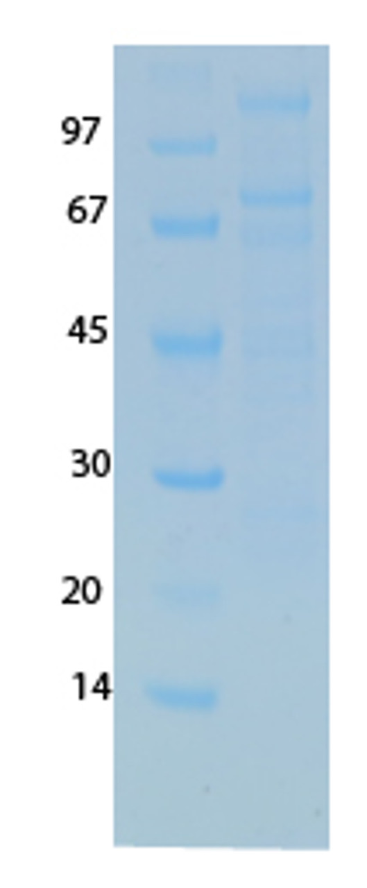 SARS-CoV-2 (COVID-19) NSP11 NSP12 Recombinant Protein | 20-247