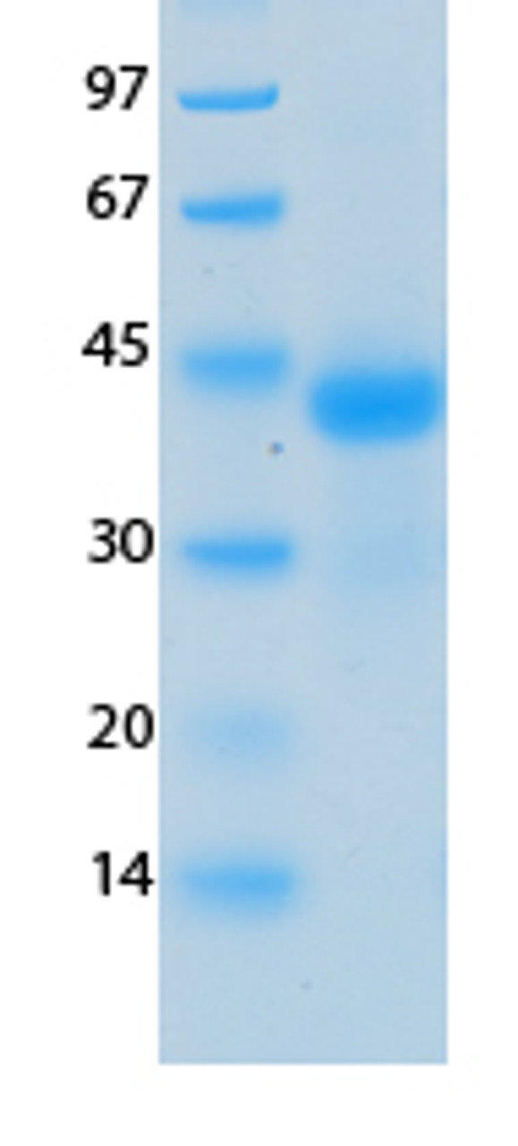 SARS-CoV-2 (COVID-19) NSP10 Recombinant Protein | 20-248