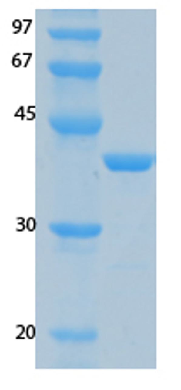 SARS-CoV-2 (COVID-19) NSP9 Recombinant Protein | 20-249