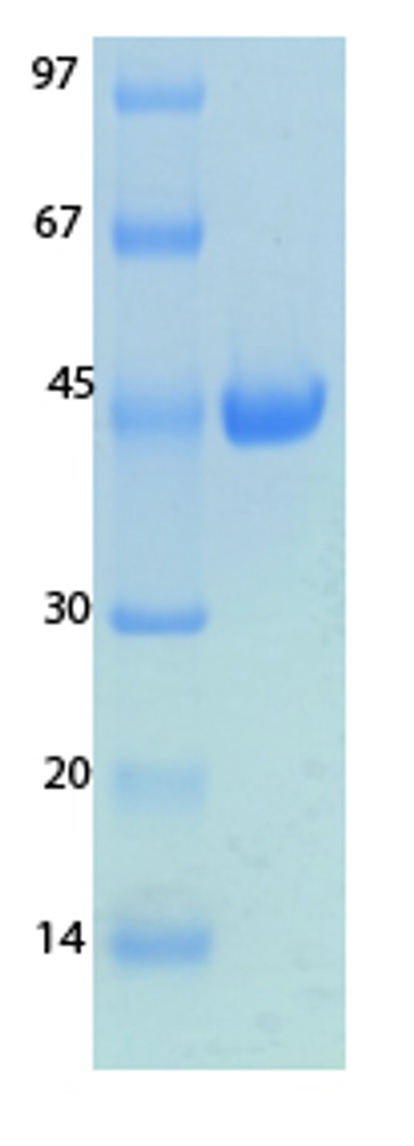 SARS-CoV-2 (COVID-19) NSP8 Recombinant Protein | 20-250