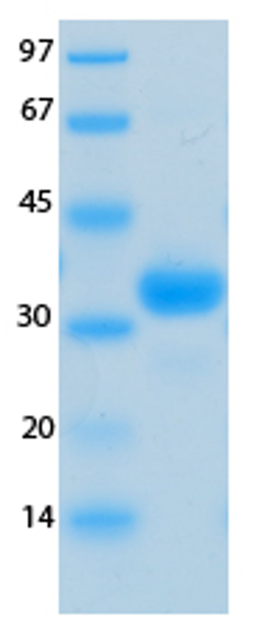 SARS-CoV-2 (COVID-19) NSP7 Recombinant Protein | 20-251
