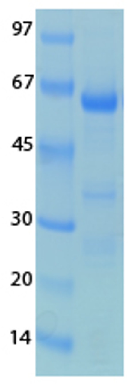 SARS-CoV-2 (COVID-19) NSP3 (743 - 1072) Recombinant Protein | 20-253