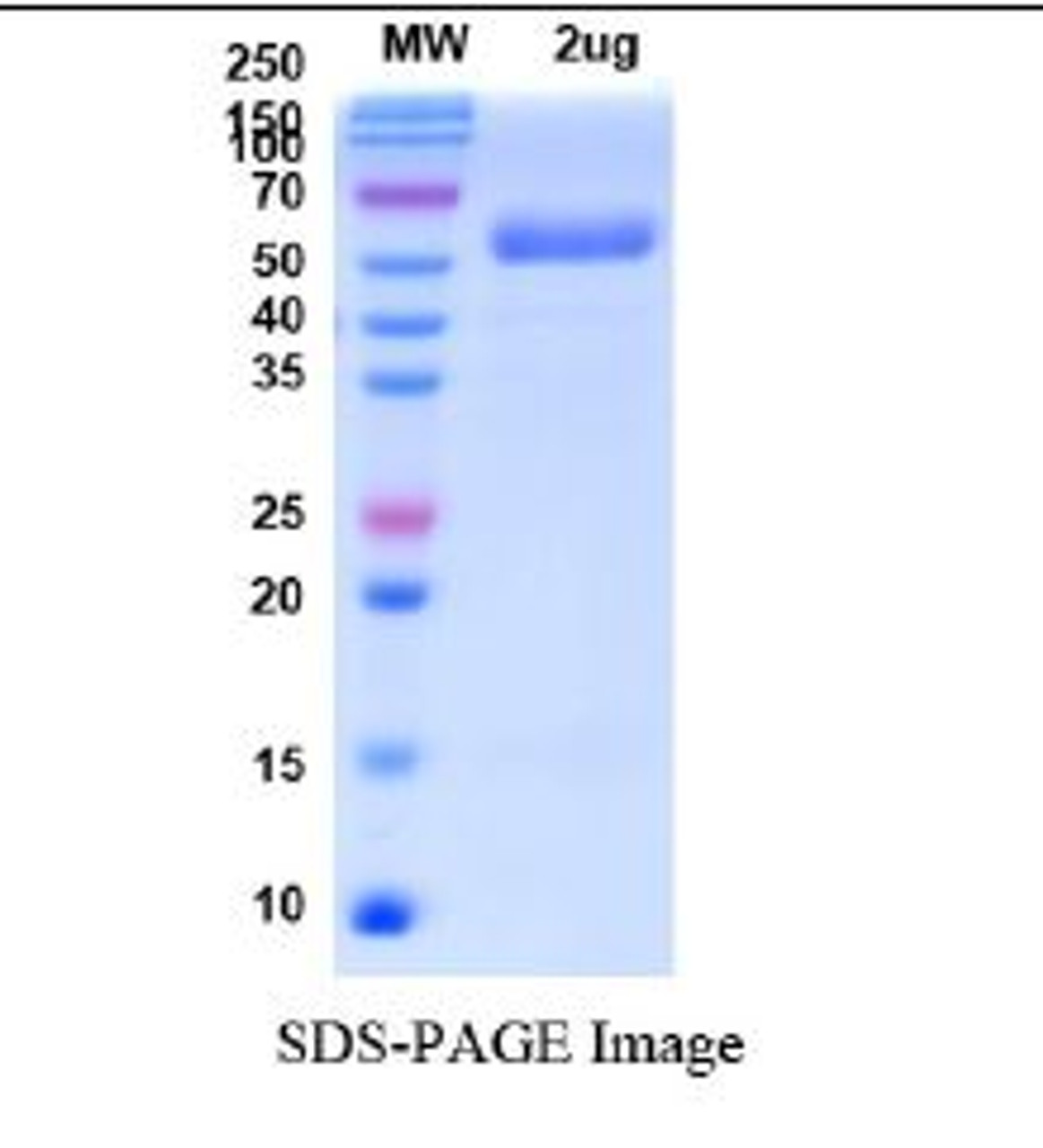 SDS-PAGE Image