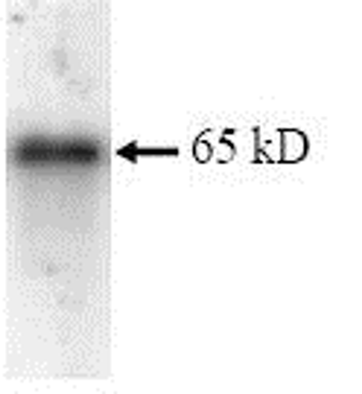 SDS Page pattern of purified IMP-3 recombinant protein was stained with Coomassie Blue.