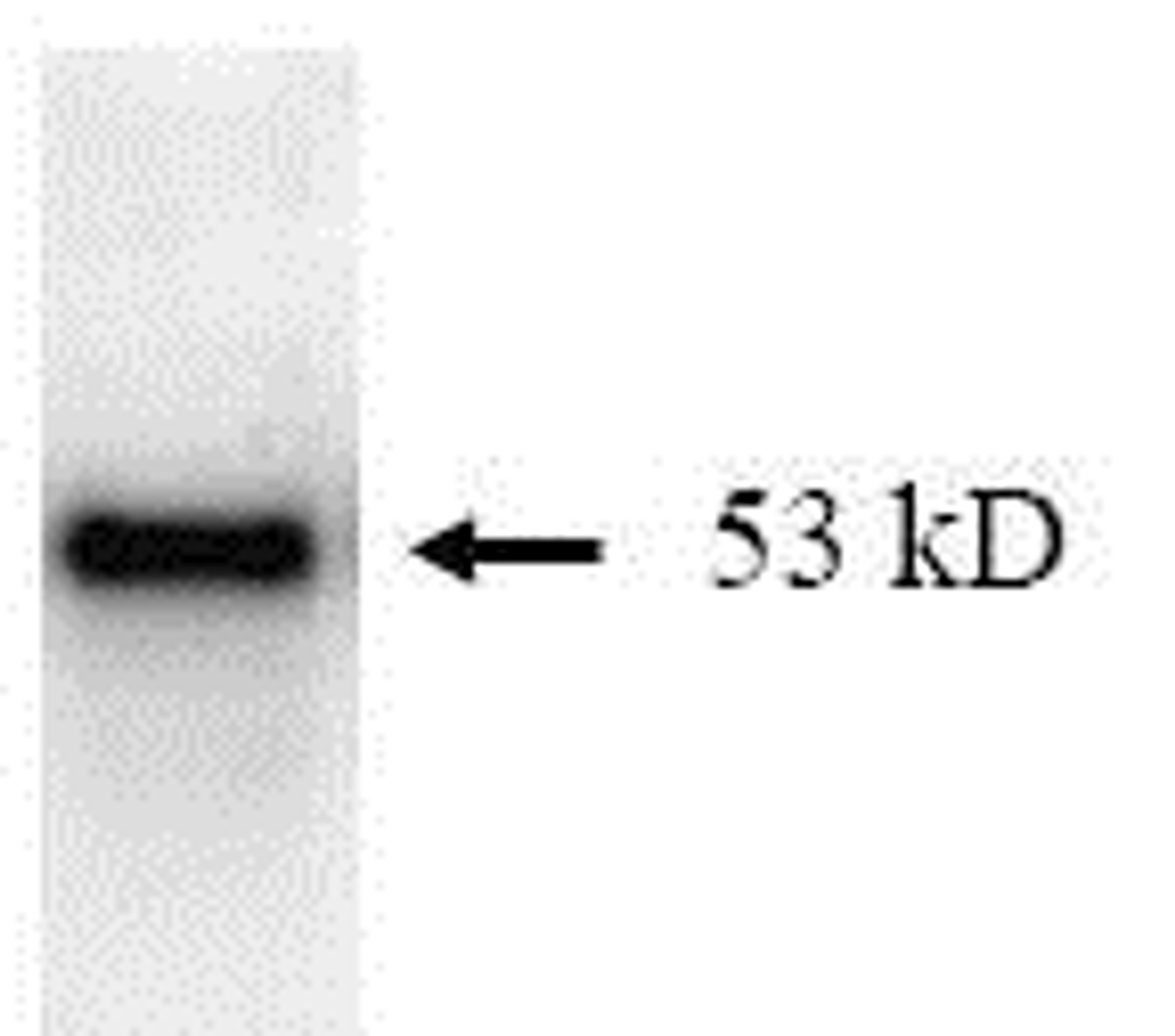 SDS Page pattern of purified p53 recombinant protein was stained with Coomassie Blue.