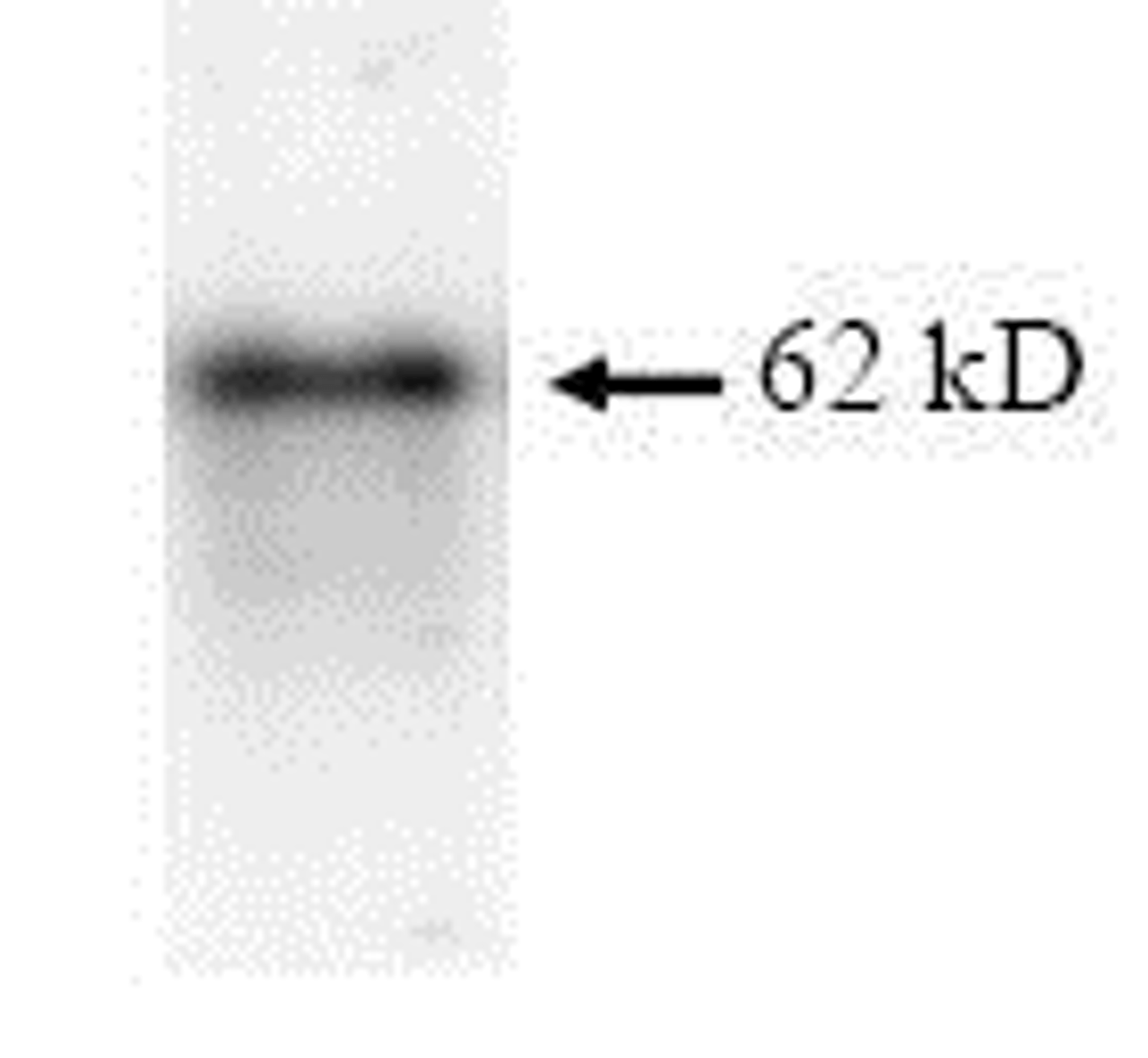 SDS Page pattern of purified p62 recombinant protein was stained with Coomassie Blue.