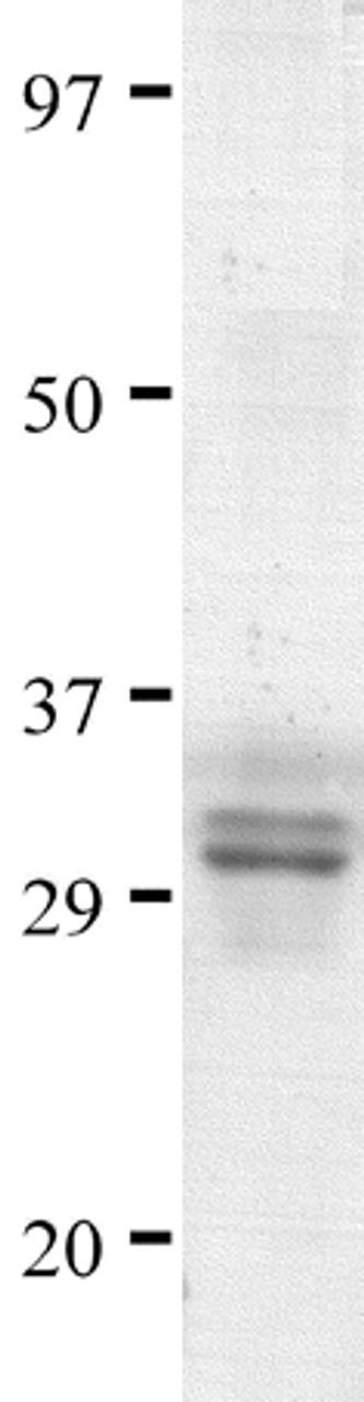 SDS-PAGE analysis of recombinant sCD4 fragment on Coomassie Blue-stained 4-20% gradient gel.