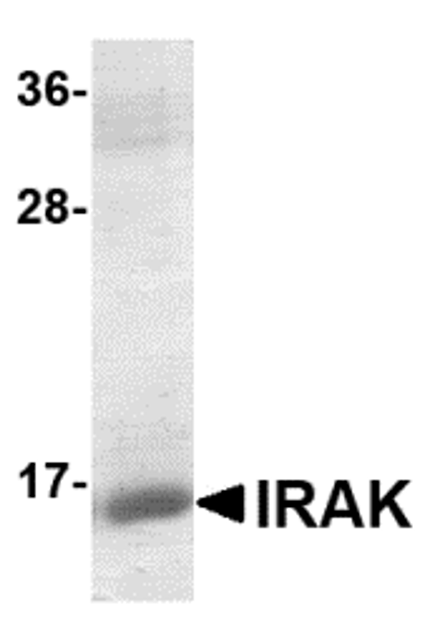 SDS-PAGE analysis of recombinant IRAK fragment on Coomassie Blue-stained 12% SDS-PAGE gel.