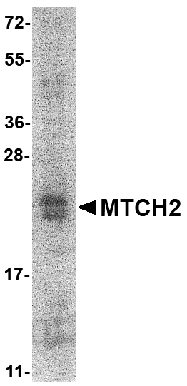 SDS-PAGE analysis of recombinant MTCH2 on Coomassie Blue-stained 12% SDS-PAGE gel.
