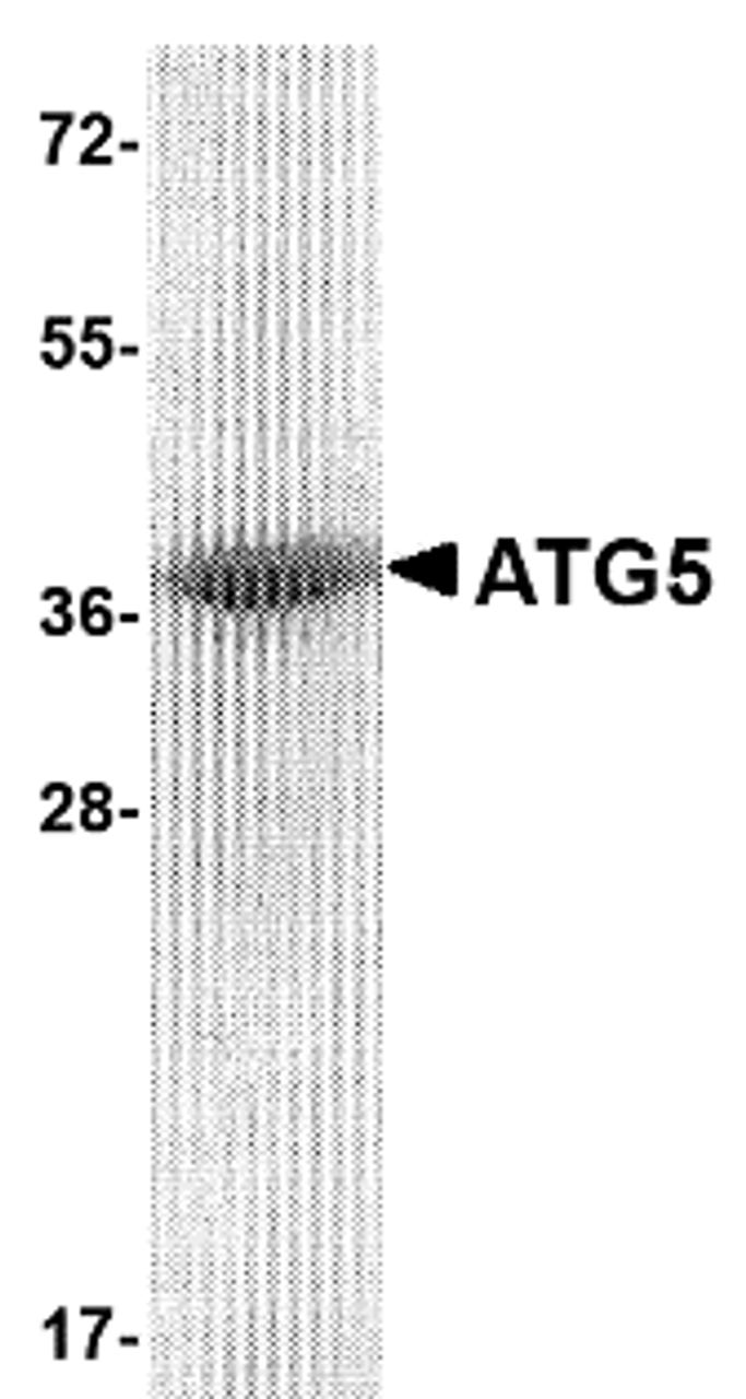 SDS-PAGE analysis of recombinant ATG5 on Coomassie Blue-stained 4 - 12% SDS-PAGE gel.
