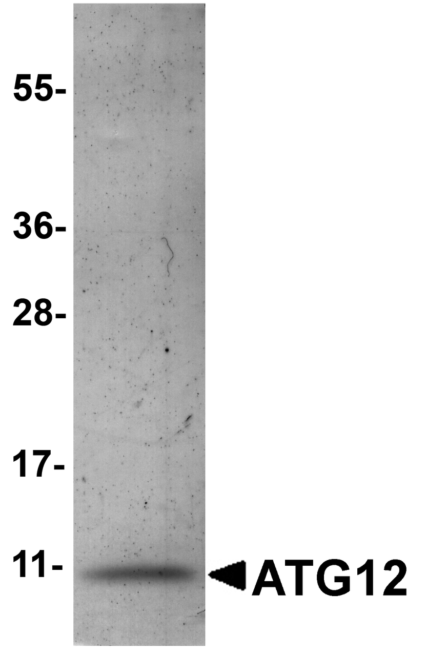 SDS-PAGE analysis of recombinant ATG12 on Coomassie Blue-stained 4 - 12% SDS-PAGE gel.