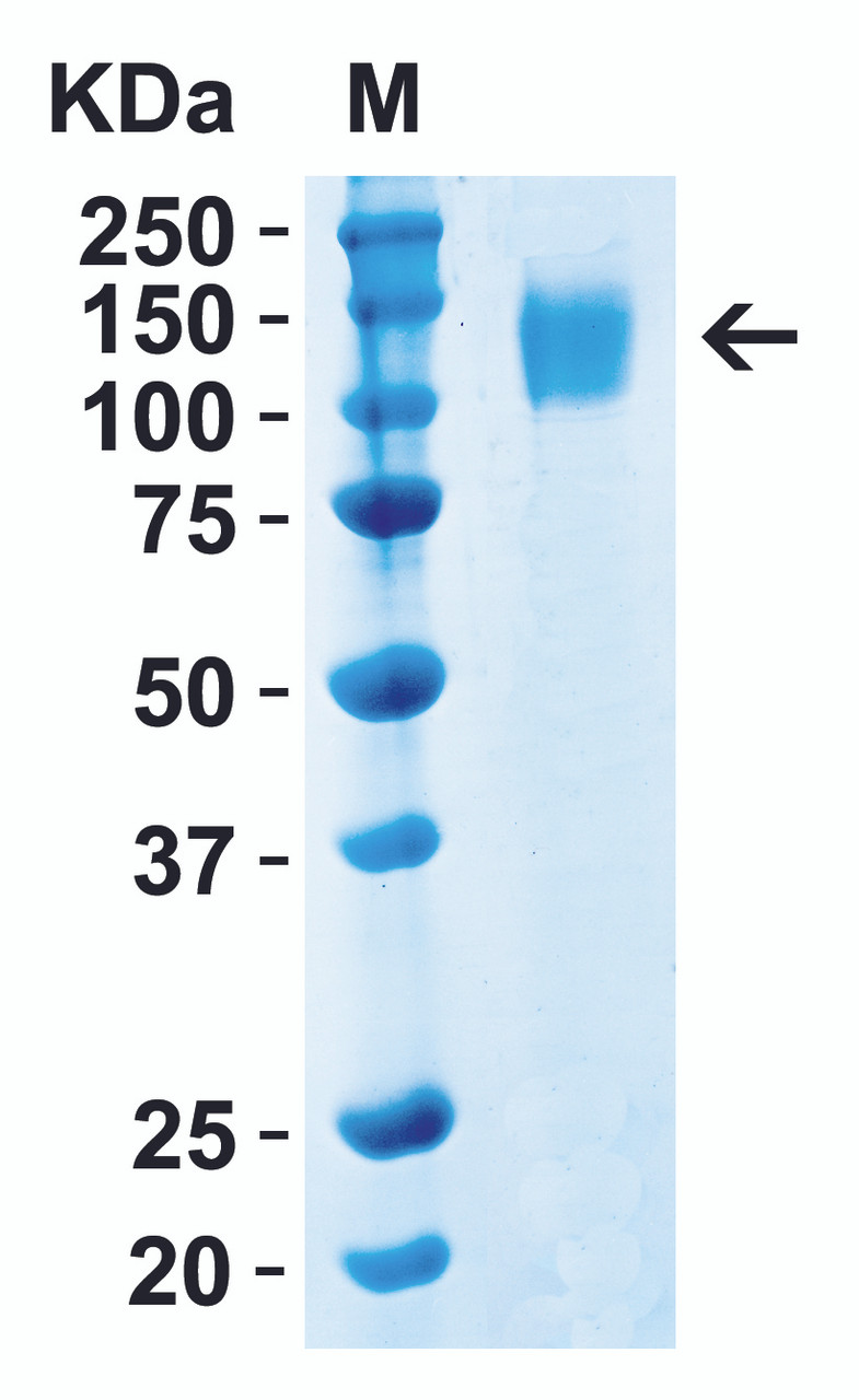 SDS-PAGE Validation of SARS-CoV-2 (COVID-19) Delta Variant Spike S1 Recombinant Protein 
Loading: 1 ;g SARS-CoV-2 (COVID-19) Delta variant Spike S1 recombinant protein, 95-127.
Observed: 120kD