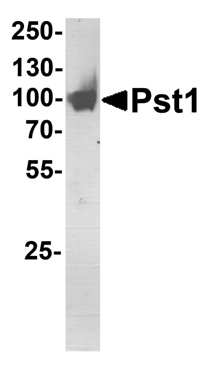 SDS PAGE analysis of Pst1 protein. Purified Pst1 protein (0.5 ;g) was separated by 10% SDS PAGE gel, and stained with silver.