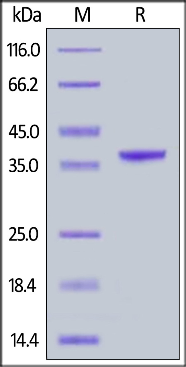 Human Arginase 1, His Tag on SDS-PAGE under reducing (R) condition. The gel was stained overnight with Coomassie Blue. The purity of the protein is greater than 95%.