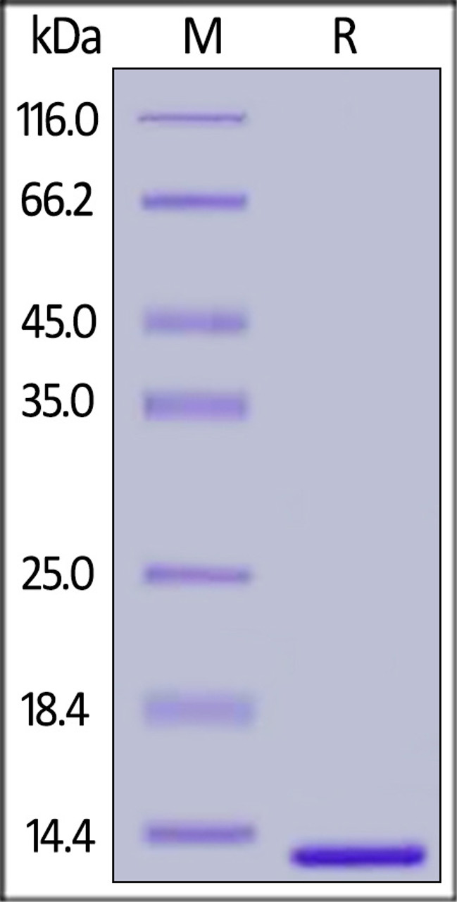 Human B2M, His Tag on SDS-PAGE under reducing (R) condition. The gel was stained overnight with Coomassie Blue. The purity of the protein is greater than 98%.