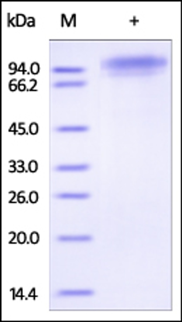 Human C1q R1, His Tag on SDS-PAGE under reducing (R) condition. The gel was stained overnight with Coomassie Blue. The purity of the protein is greater than 95%.