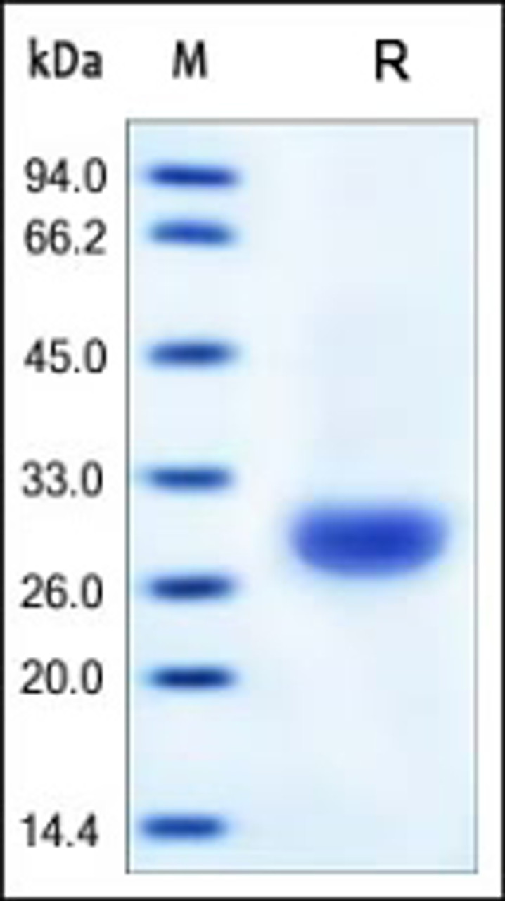 Human CA2, His Tag on SDS-PAGE under reducing (R) condition. The gel was stained overnight with Coomassie Blue. The purity of the protein is greater than 95%.