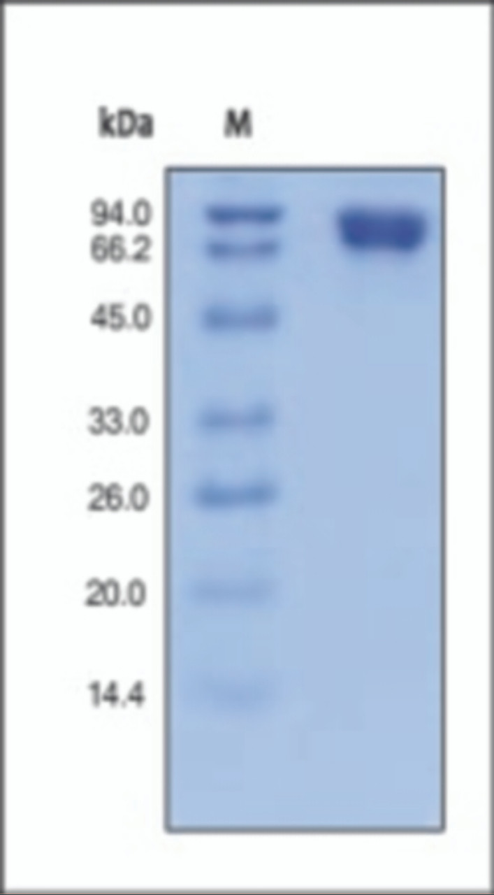 The purity of rh CD146 was determined by DTT-reduced (+) SDS-PAGE and staining overnight with Coomassie Blue.