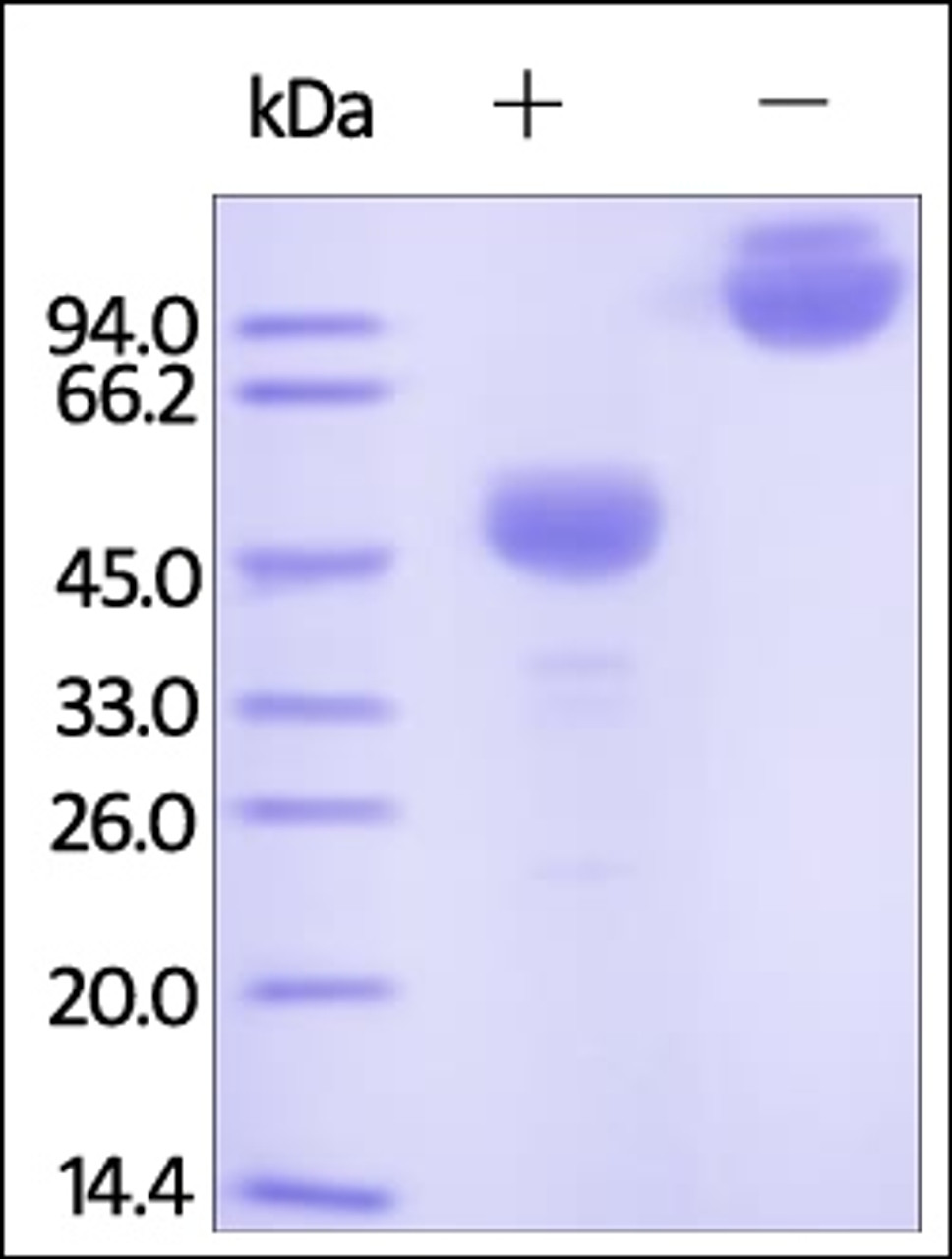 Cynomolgus / Rhesus macaque CTLA-4, Fc Tag on SDS-PAGE under reducing (R) and non-reducing (NR) conditions. The gel was stained overnight with Coomassie Blue. The purity of the protein is greater than 95%.