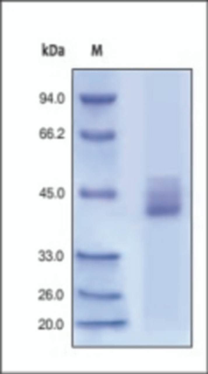 The purity of rh CXCR4 Fc Chimera was determined by DTT-reduced (+) SDS-PAGE and staining overnight with Coomassie Blue.