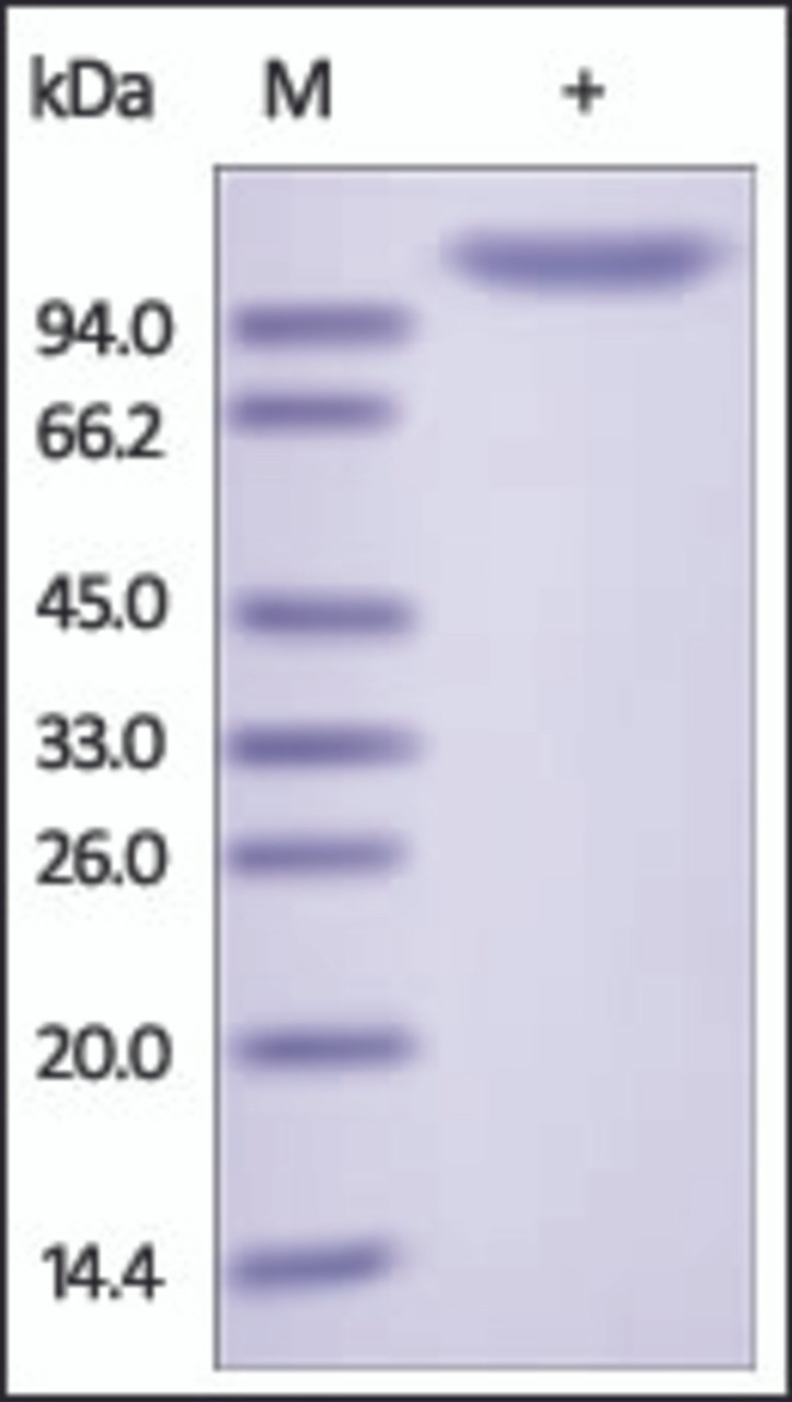 The purity of rh ENPP2 / Autotaxin was determined by DTT-reduced (+) SDS-PAGE and staining overnight with Coomassie Blue.