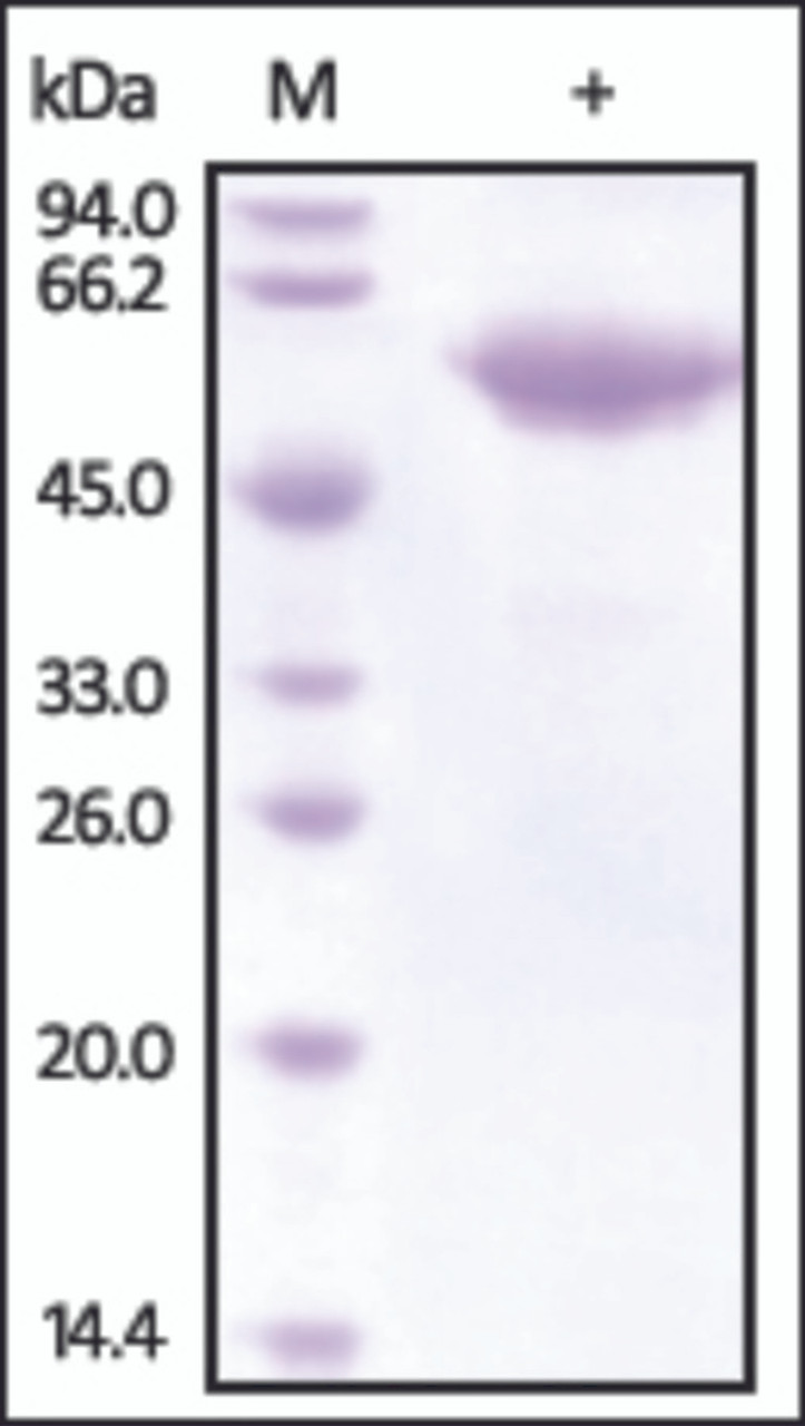 The purity of rh FETUB / Fetuin-B was determined by DTT-reduced (+) SDS-PAGE and staining overnight with Coomassie Blue.