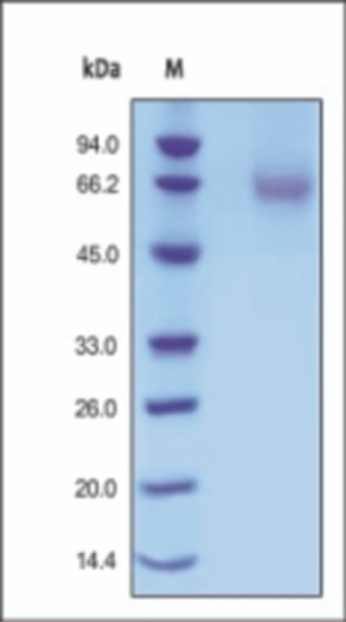 The purity of rh FGFR1 was determined by DTT-reduced (+) SDS-PAGE and staining overnight with Coomassie Blue.