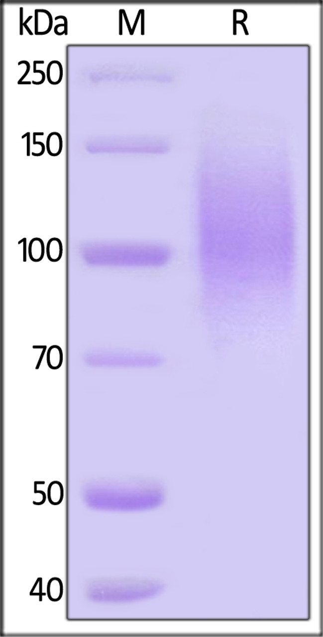 HIV-1 [HIV-1/Clade B/C (CN54) ] GP120, His Tag on SDS-PAGE under reducing (R) condition. The gel was stained overnight with Coomassie Blue. The purity of the protein is greater than 95%.