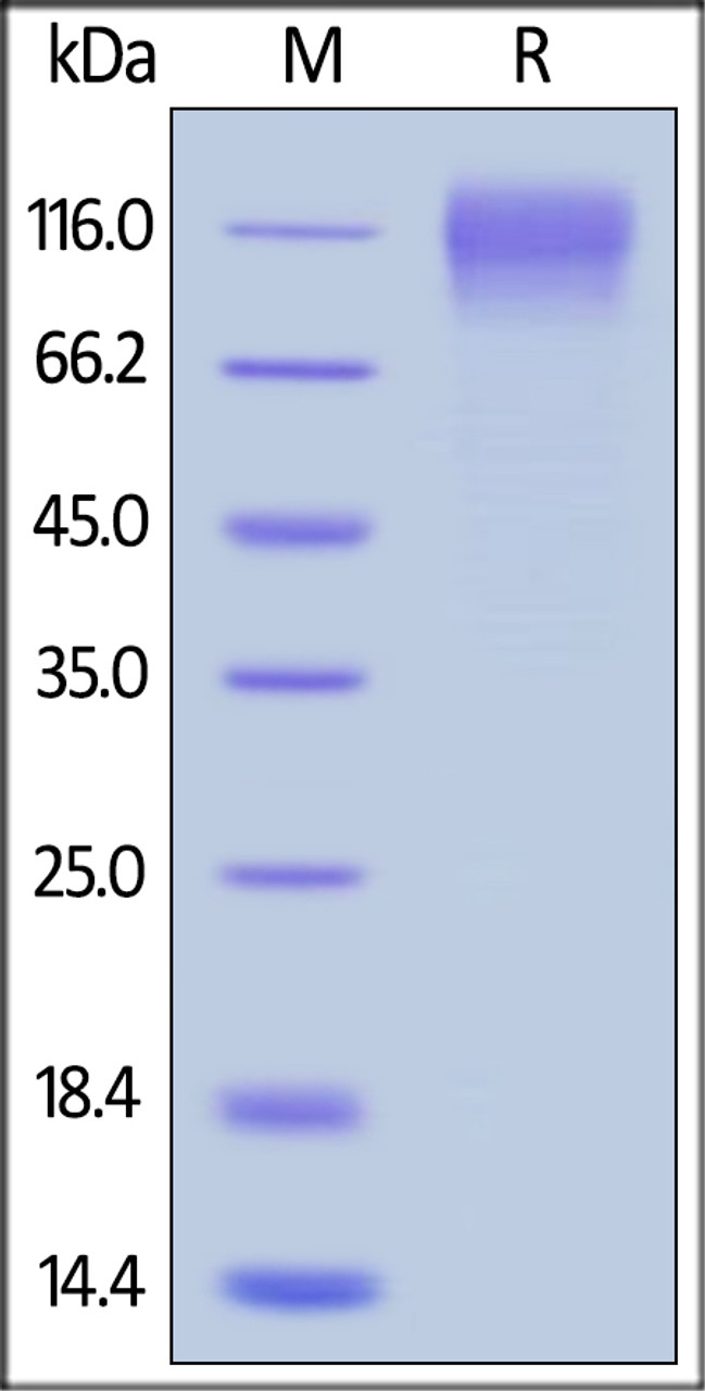 HIV-1 [HIV-1/Clade C (16055) ] GP120, His Tag on SDS-PAGE under reducing (R) condition. The gel was stained overnight with Coomassie Blue. The purity of the protein is greater than 95%.