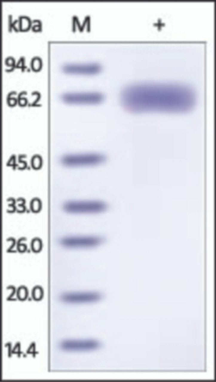 The purity of HA (H7N9) -Shanghai was determined by DTT-reduced (+) SDS-PAGE and staining overnight with Coomassie Blue.